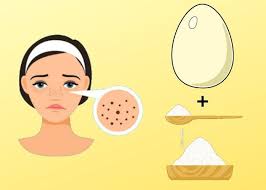 Yumurta Aki Ve Seker Ile Ev Ortaminda Kolayca Yapabileceginiz Guzellik Maskesi Ile Siyah Noktalari Tedavi Edebilir Dah Blackheads Skin Mask Homemade Skin Care