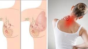 Symptoms to look for include: The First Symptoms Of Breast Cancer When Chest Pain Is An Alarm Signal