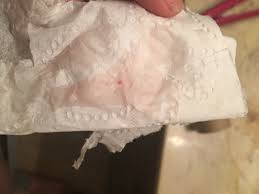 Can implantation bleeding be heavy conceive success. 9 Dpo Had This Light Pink Spotting All Day When I Wipe Only Implantation Spotting Glow Community