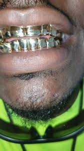 Check spelling or type a new query. Gold Plugz Gold Teeth Home Facebook