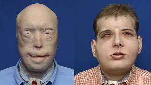 Amerikalı itfaiyecinin yüzü baştan yaratıldı