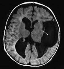 Si vous connaissez une source ancienne, une première attestation méconnue, ou si vous pouvez compléter l'étymologie ou corriger une erreur, cette notice a besoin de votre aide. Neuro Ophthalmologic Manifestations Of Systemic And Intracranial Disease Springerlink