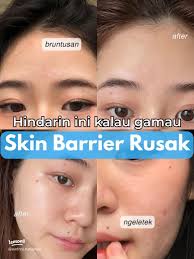 Kesalahan Umum yang Merusak Skin Barrier dan Cara Menghindarinya