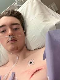 Z mode brake pedal not required for launch at 3500 rpm