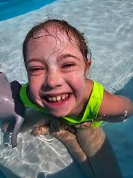 Freckles are popping this year!🥰