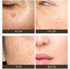 Check spelling or type a new query. Some By Mi Galactomyces Pure Vitamin C Duo Toner Serum
