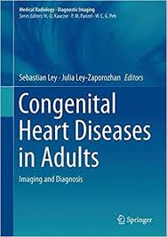 Congenital Heart Diseases In Adults Imaging And Diagnosis Medical Radiology Medical Books Free Congenital Heart Disease Disease Book Congenital Heart