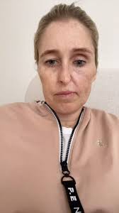 Sharon Seibel was shocked by her pancreatic cancer diagnosis. Even with a  family history of ovarian cancer and a BRCA mutation, she didn't realize  there was a connection to pancreatic cancer. After