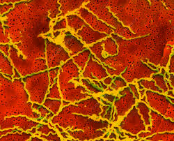 Image result for Treponema