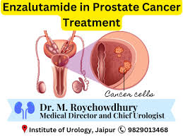 Image result for Prostate Cancer Management