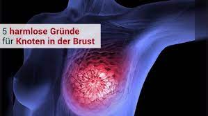 5 Harmlose Grunde Fur Einen Knoten In Der Brust