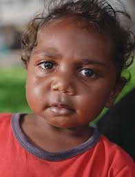 Telethon Kids Institute