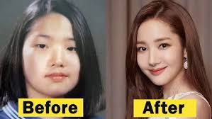 Park Min Young Plastic Surgery Rumours