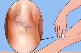 Pin On Health