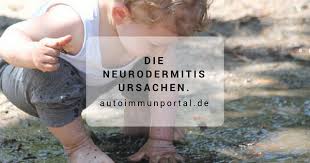 Die Neurodermitis Ursachen Die Sie Kennen Sollten Medumio