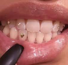 image about aesthetic in esketit by helmetboy tooth gem teeth jewelry cute jewelry