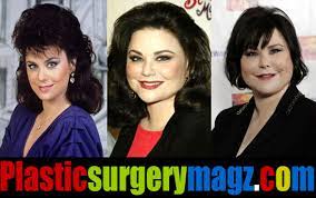 With her face partly obscured by dark sunglasses and a mask, the former tv star held a cane as she made her way to a range rover. Delta Burke Plastic Surgery Before And After Photos Plastic Surgery Magazine