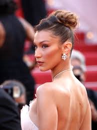 Vorher & Nachher: Diese Stars hatten Schönheits-OPs