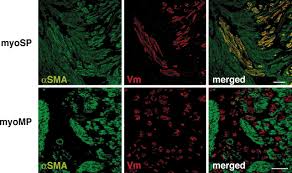 Its main function is to induce uterine contractions. Side Population In Human Uterine Myometrium Displays Phenotypic And Functional Characteristics Of Myometrial Stem Cells Pnas