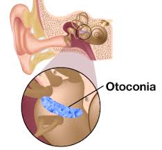 Ear piercing is a common cosmetic procedure, but not one without risk of infection. Bppv Baltimore Md Owings Mills Md Westminster Md Ent