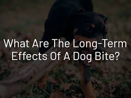 We did not find results for: What Are The Long Term Effects Of A Dog Bite Knowles Law Firm Knowles Law Firm