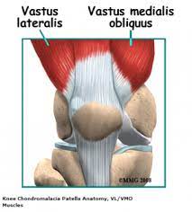 Chondromalacia Patellae Physiopedia