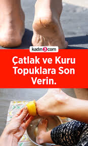 Catlak Ve Kuru Topuklara Son Verin Cilt Bakimi Organik Cilt Bakimi Dogal Cilt