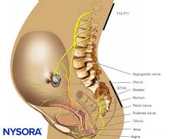 Image result for Paracervical Block