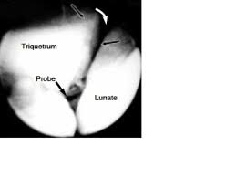 Image result for Shuck Test