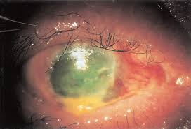 Image result for Trochomeria subglabra