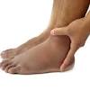 Japan, the swollen feet and face? 1