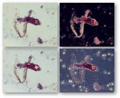 Image result for Urinary Cast