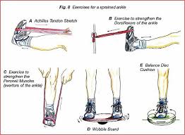 Chiropractor In Toronto On Canada Ankle Strain And Sprain Sprained Ankle Twisted Ankle Ankle Sprain Recovery
