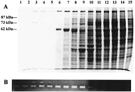 Image result for Silver Grey 1999 AAV