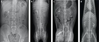 Symptoms of kidney stones in cats include tenderness or pain along the lower back or blood in the urine. Animal Models Of Naturally Occurring Stone Disease Nature Reviews Urology