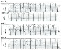 Temperature Chart Above Showing Fever Spikes Ranging From