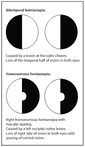 How To Examine The Visual System Part 1 Visual Acuity