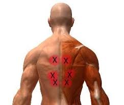 Pin On Mid Back Pain Relief