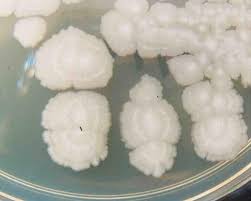 bacterial colony morphology identification article with