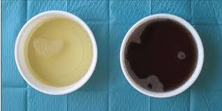 Air kencing kehijauan boleh menjadi keadaan biasa jika anda menggunakan terlalu banyak jenis makanan, seperti asparagus. Air Seni Berwarna Hitam Ini 5 Kemungkinan Penyebabnya Merdeka Com