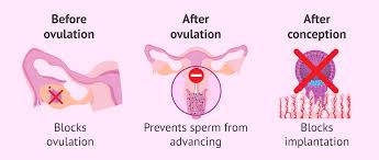 If you take the pill within 72 hours after you've had unprotected sex, levonorgestrel can reduce the risk of pregnancy by up to 87% if taken as directed. Costs And Effects Of The Morning After Pill