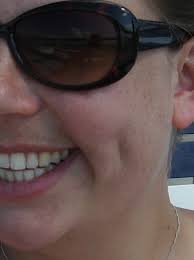 Karyn (Sobczak) Elliott's Dimples