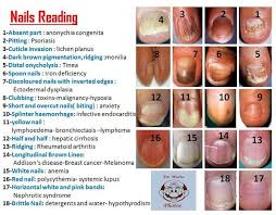 Nails Reading Chart Nail Disorders Fingernail Health Nail Health