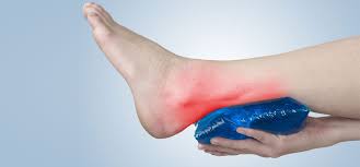 Pin On Achilles