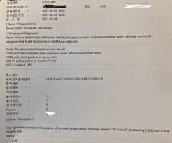 .live mbc뉴스투데이 2020년 1월 1일 날씨 내일도 고온 계속.중서부, 미세먼지 여전 (2021.02.20/뉴스데스크/mbc) '혈액암 오진'에 아내 숨져…진실 알고 싶다 청원. Arhutqsdune0am