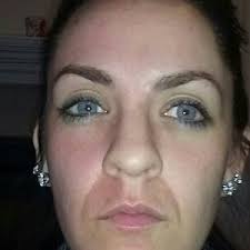 Maybe you would like to learn more about one of these? Dermawand Reviews Was It Worth It Realself