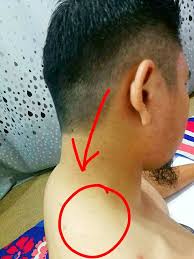 Maybe you would like to learn more about one of these? Sakit Bahu Kanan Sehingga Tak Boleh Tidur Sentuhan Yang Berbeza
