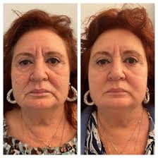 Dr. Francesco D'Angelo