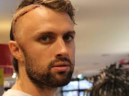 Jacob Walker: Carrie Bickmore inspires brain cancer sufferer