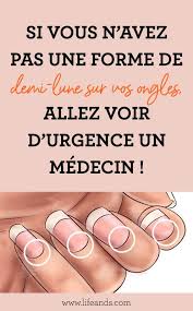 S Il N Y A Pas De Forme De Demi Lune Sur L Ongle Veuillez Consulter Immediatement Un Medecin Esprit Sante Ongles En Bonne Sante Vernis A Ongles Fait Maison Aliments Bons Pour
